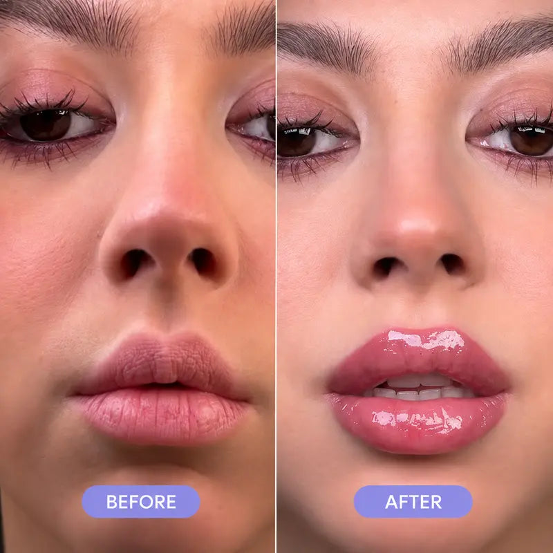 KoreaGlow Lip Plump