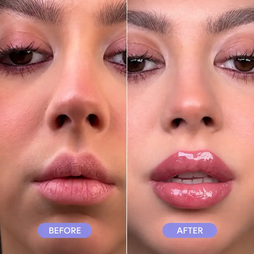 KoreaGlow Lip Plump